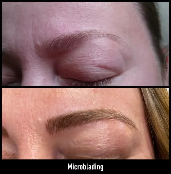 Antes y después de microblading, segundo ejemplo